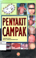 PENYAKIT CAMPAK